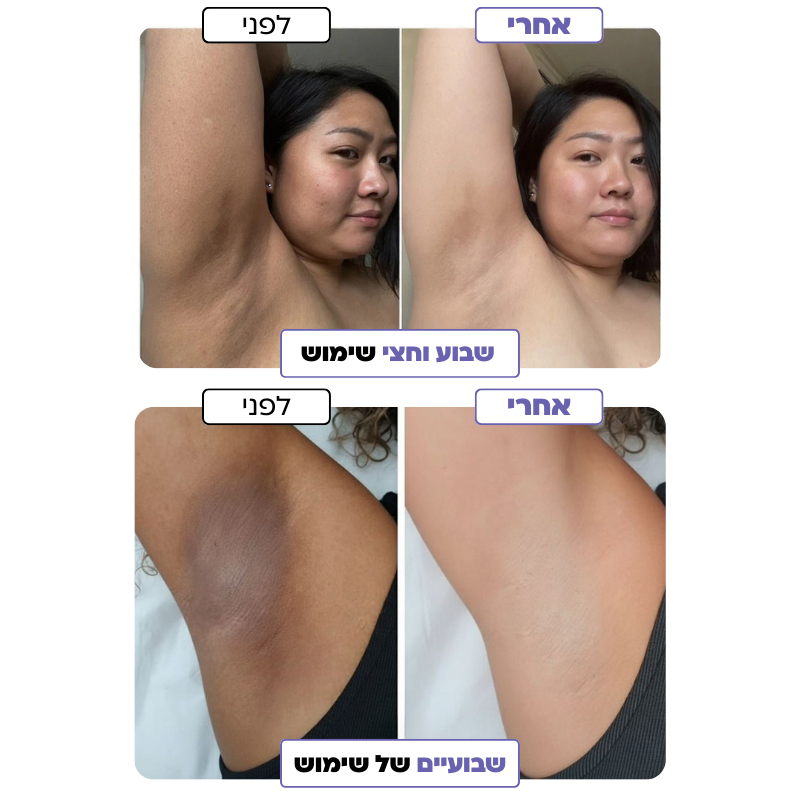 GLOWRA – הפתרון לכהויות