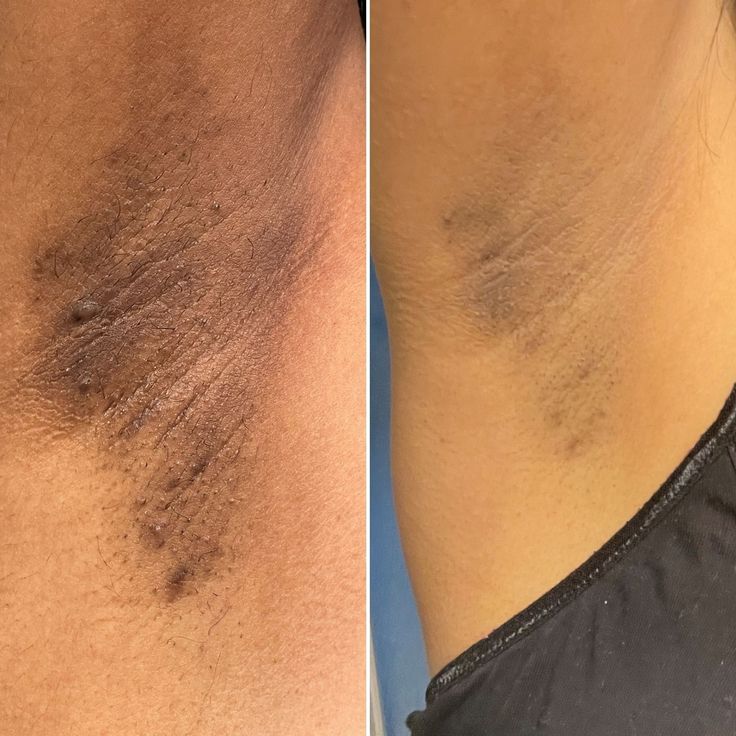 GLOWRA – הפתרון לכהויות