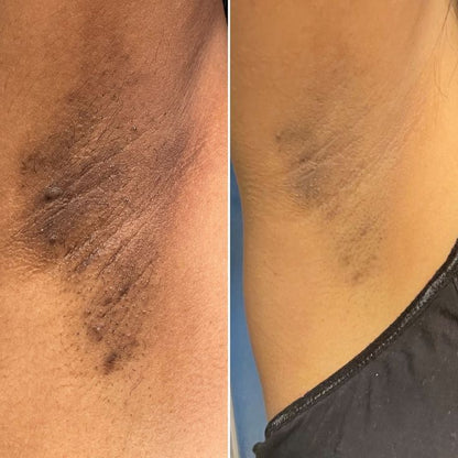 GLOWRA – הפתרון לכהויות